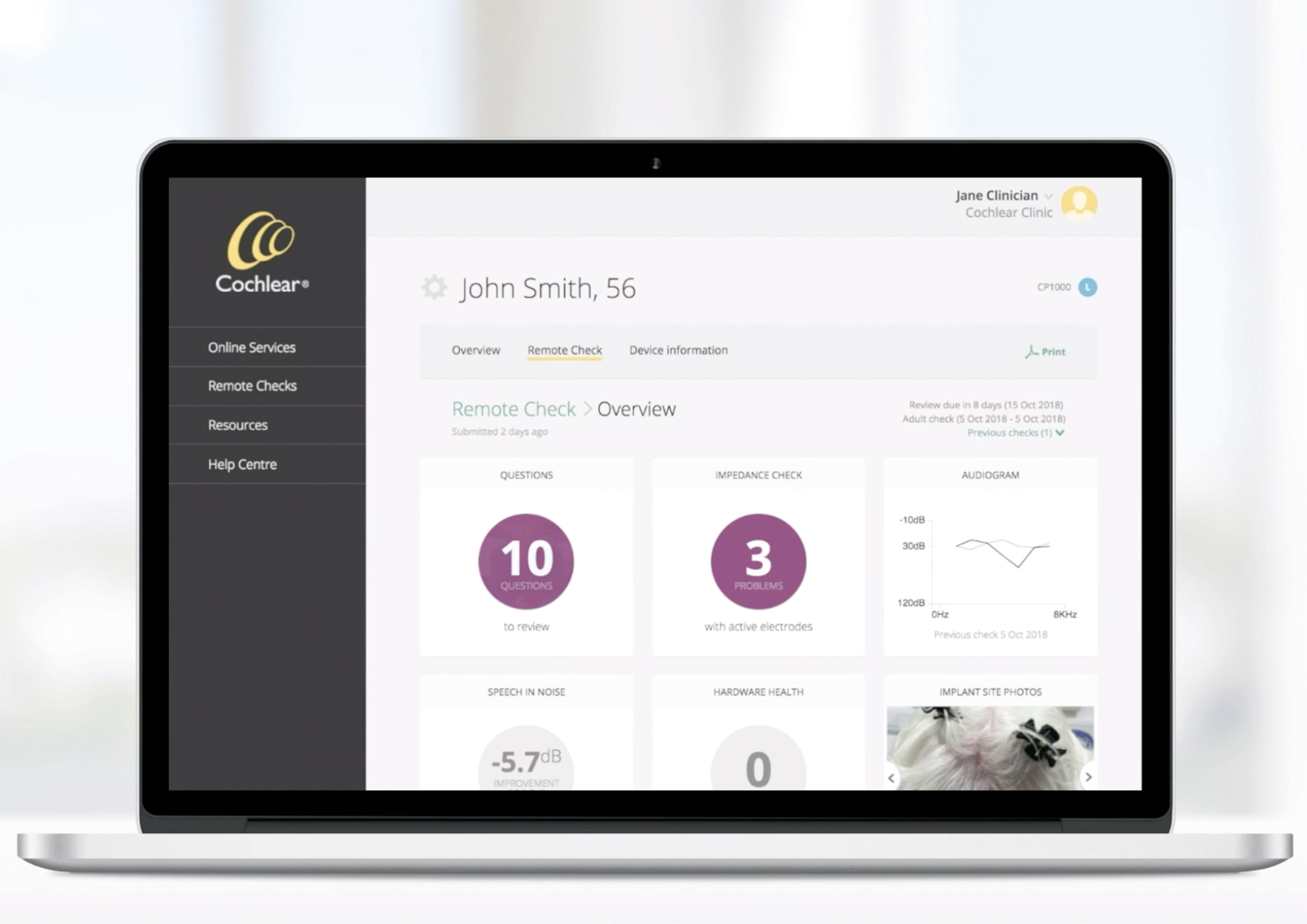 Remote check for clinicians process image