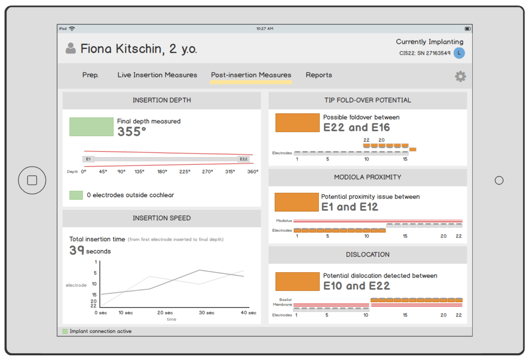Wireframes process image