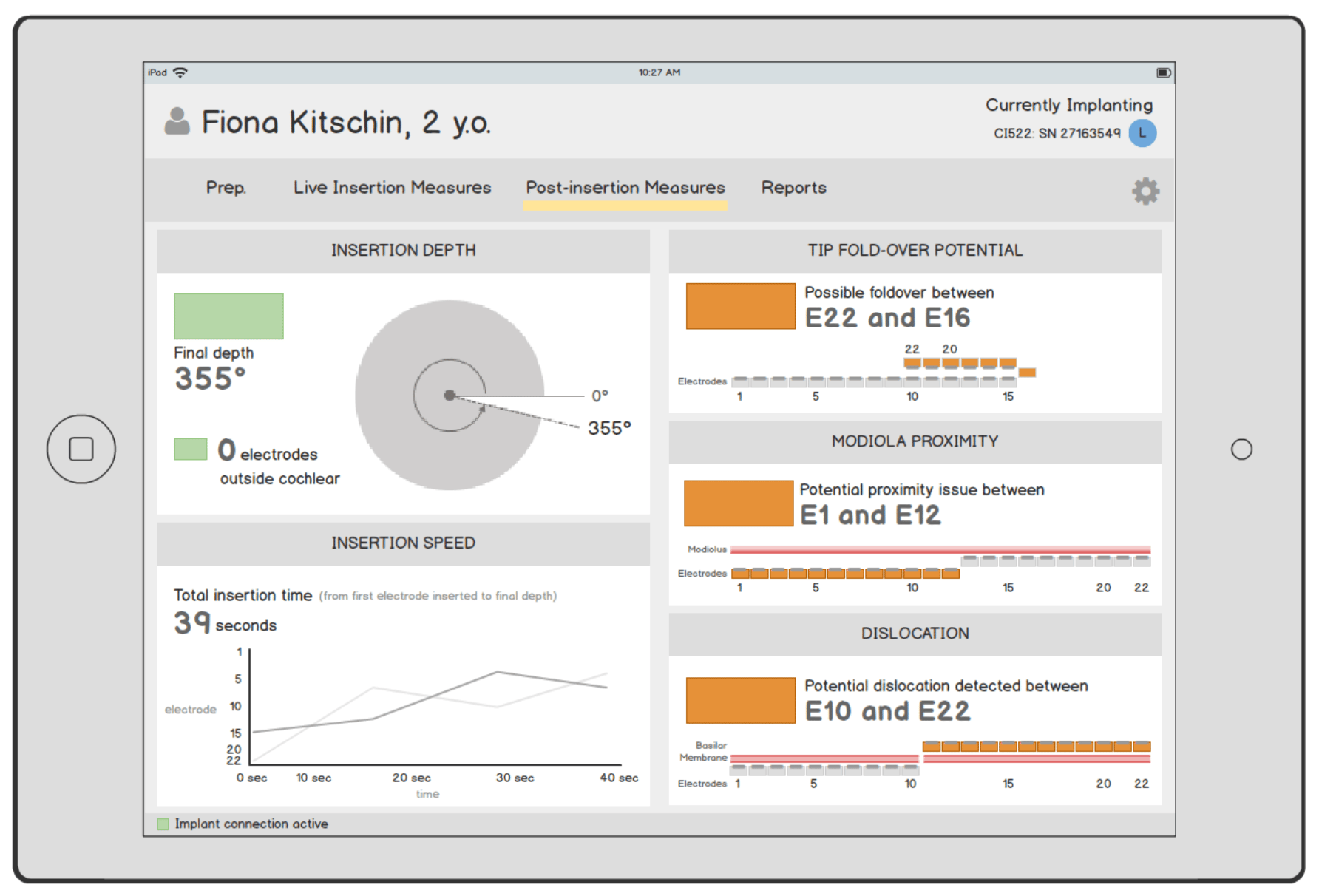 Wireframes process image